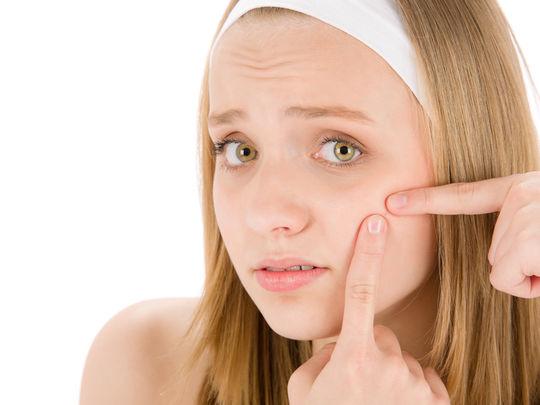 Comment faire disparaître un bouton d'acné sur le visage en 48h ?